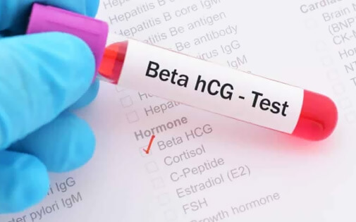 Beta HCG Değerleri Nasıl Olmalı?